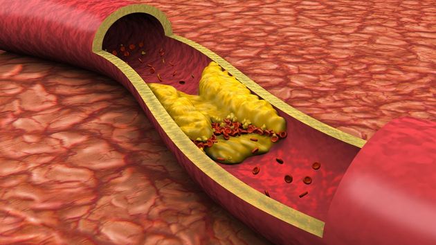 Una nutricionista revela qué alimentos comer para rebajar los niveles de colesterol de forma natural