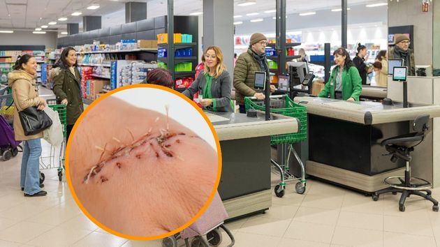 La justicia deniega la incapacidad permanente a un pescadero de Mercadona que se cortó la mano, pero le dan una indemnización de 540 euros por las “lesiones permanentes”
