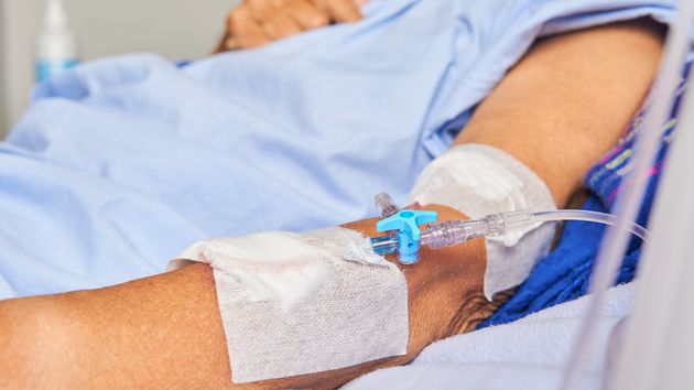 Un trabajador sufre un infarto por estrés laboral y acaba despedido a los meses de volver de la baja: es improcedente pero no nulo
