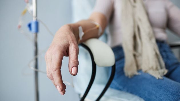 Una mujer estuvo 4 años con quimioterapia sin tener realmente cáncer y condenan al hospital a indemnizarla con 467.000 euros