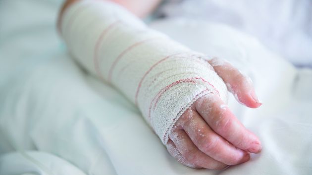 La Seguridad Social permite volver a cobrar la prestación por incapacidad temporal por la misma patología a los afectados denegados que tengan opciones de recuperación