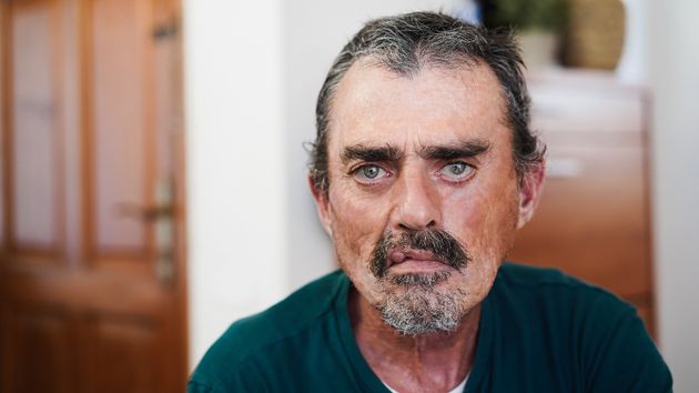 Un vigilante de seguridad de 49 años pierde la incapacidad permanente absoluta por decir que se encontraba “contento y estable” de su trastorno psiquiátrico