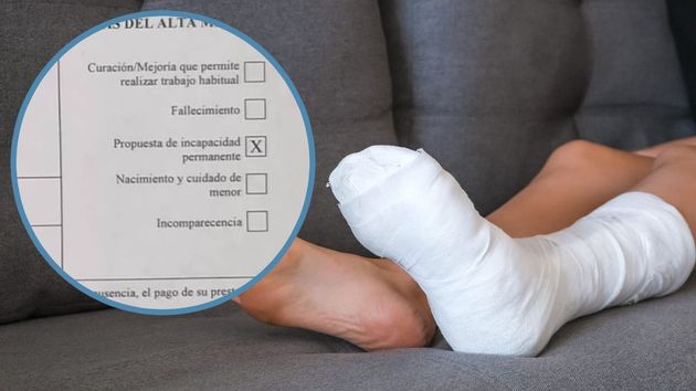 Qué significa el “alta médica con propuesta de incapacidad permanente”