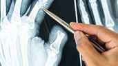 Radiografía de unas manos