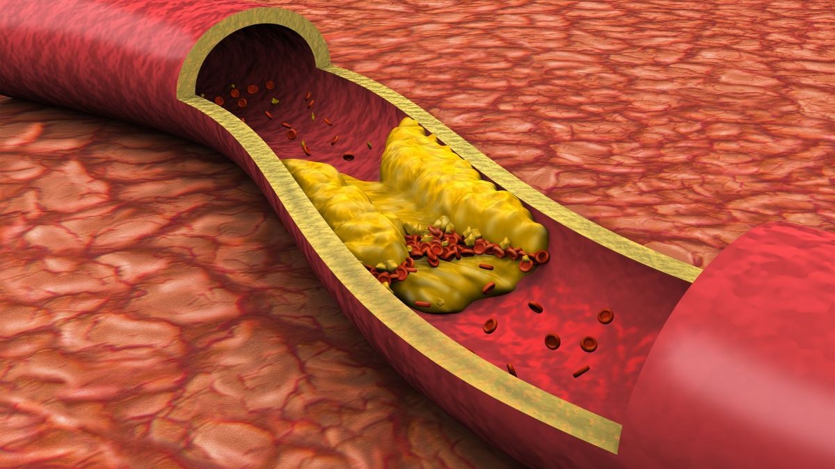 La fruta perfecta para mantener las venas y arterias limpias de forma natural