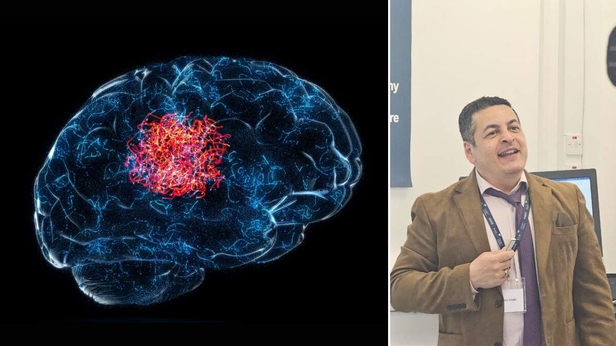 Ni el CrossFit ni la natación: el ejercicio definitivo para prevenir el Alzheimer, según el doctor Coppi