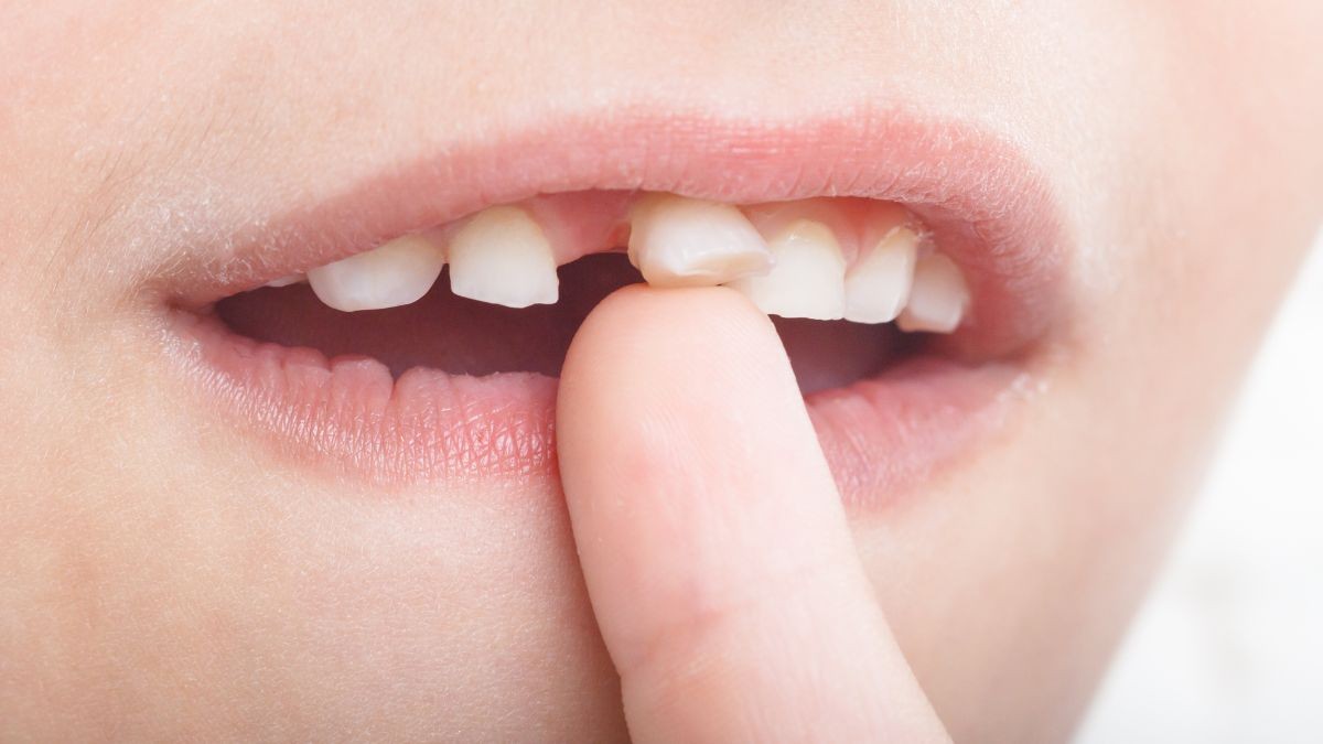 Esta es la razón de por qué debemos guardar los dientes de leche de los pequeños