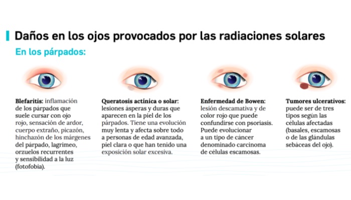 Calor ojos